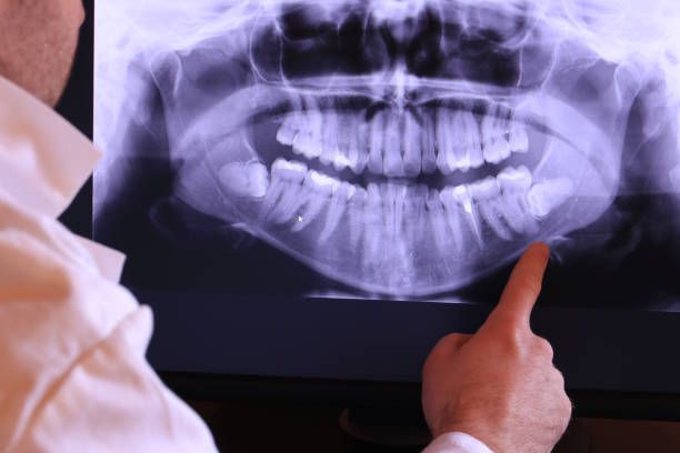 Emergency Gum Pain Relief in DE