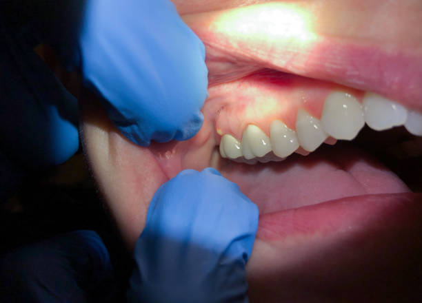 Best Emergency Gum Pain Relief  in Rodney Village, DE
