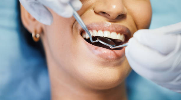 Best Teeth Whitening  in Rodney Village, DE