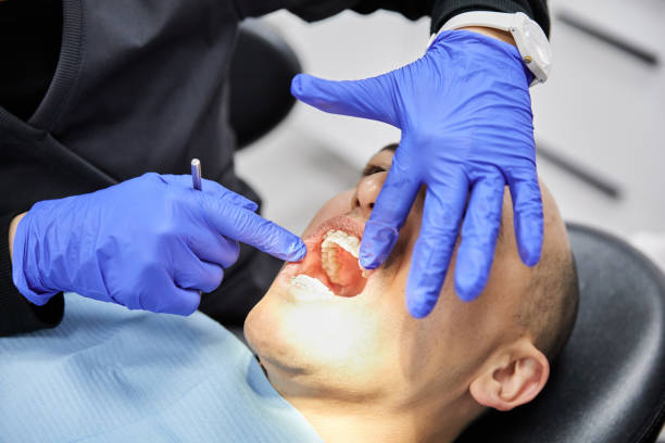 Best Root Canal Emergency Dentist  in Rodney Village, DE