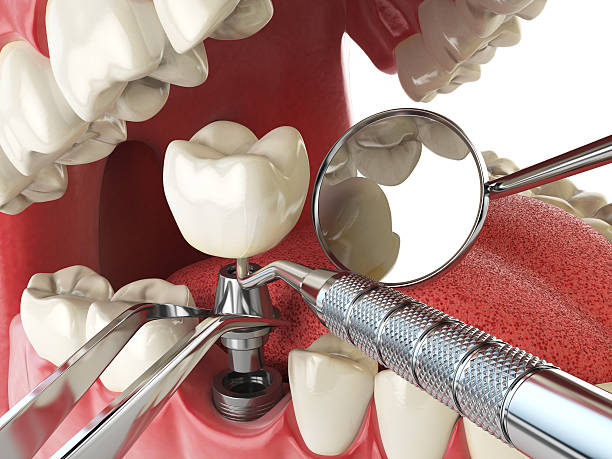 Best Cracked Tooth Emergency Dentist  in Rodney Village, DE